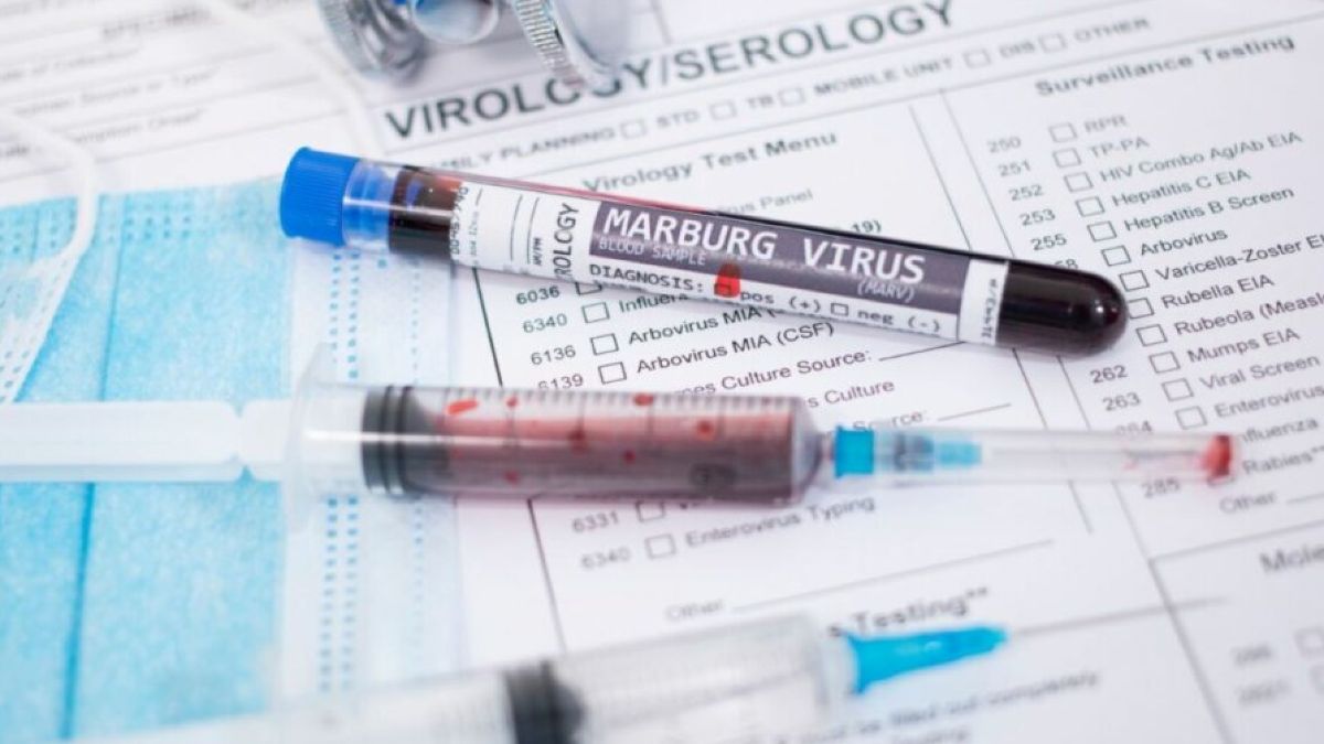 Ποιος είναι ο θανατηφόρος ιός Marburg που θερίζει την Αφρική και έφτασε στην Ευρώπη –  Πώς μεταδίδεται