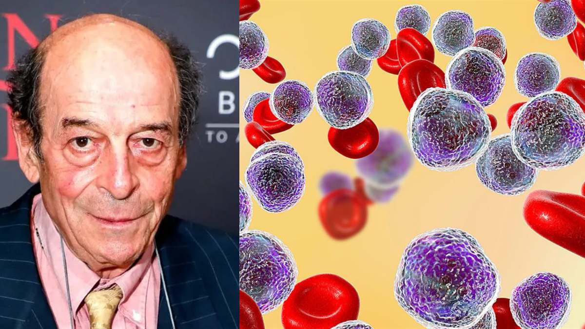 Πέθανε από οξεία λευχαιμία ο Μανουσάκης: Δεν έχει ηλικία η νόσος –  Τα ύπουλα σημάδια και η αντιμετώπιση