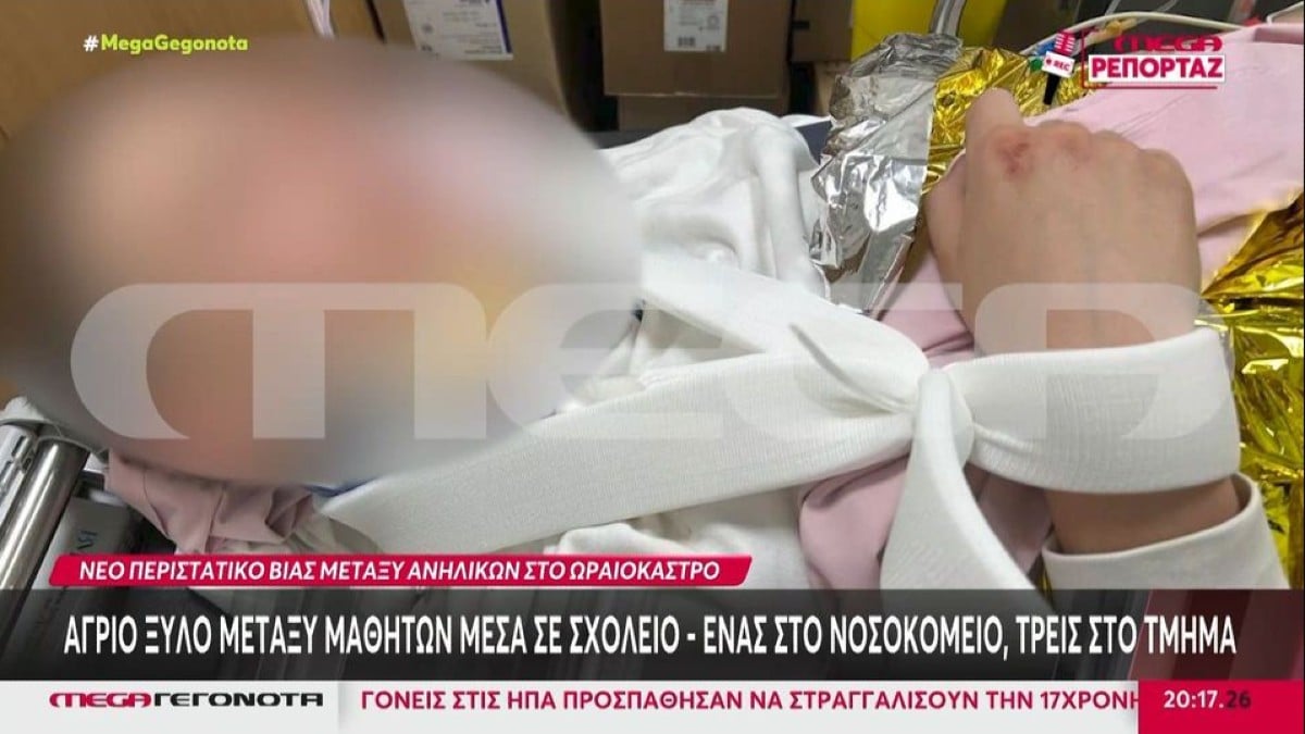 Άγρια συμπλοκή ανηλίκων σε σχολείο: «Του έσπασαν τον ώμο και τον αυχένα» – Αφορμή ένα…βλέμμα